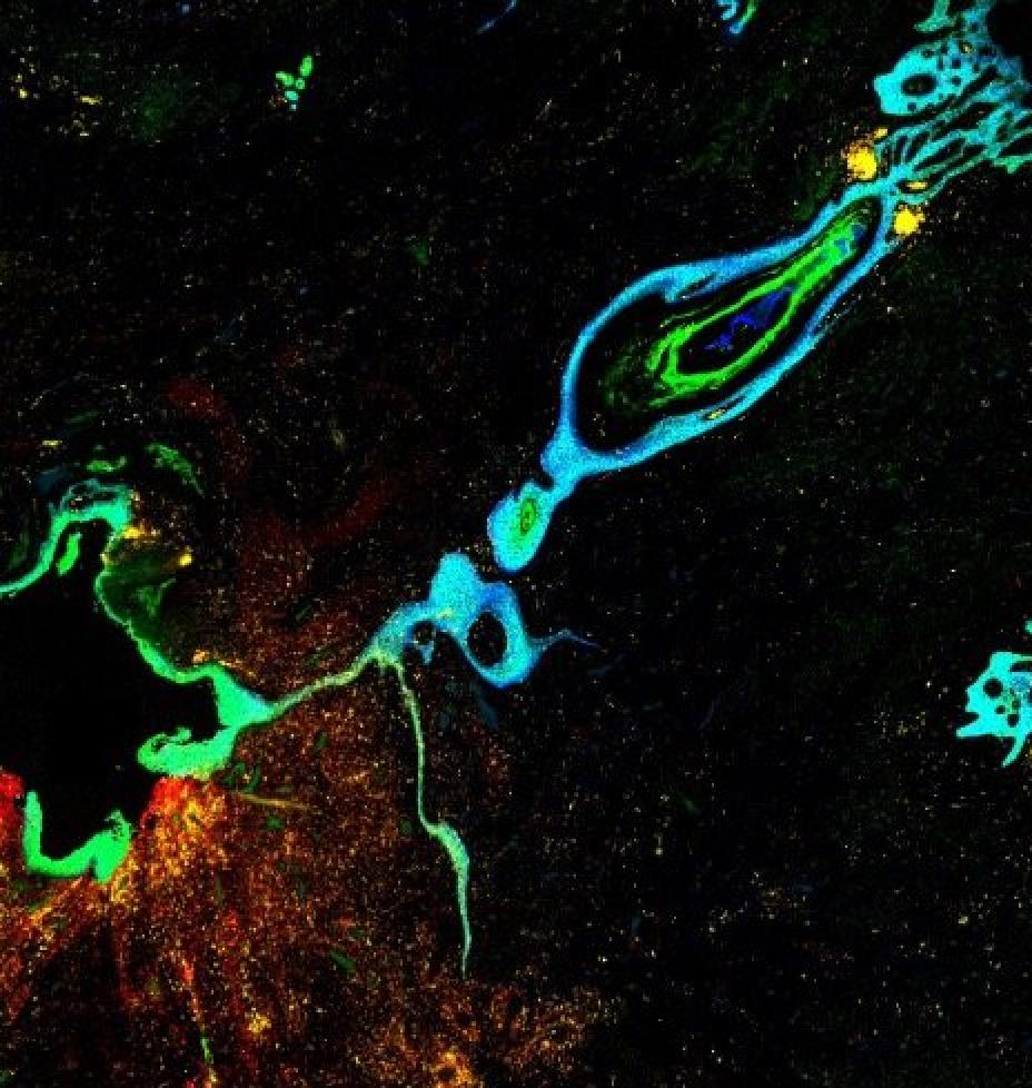 Spacial omics data visualisation analysis that can be used to identify cell types and spatial patterns in tissue sections through the use of spatial transcriptomics and spatial proteomics