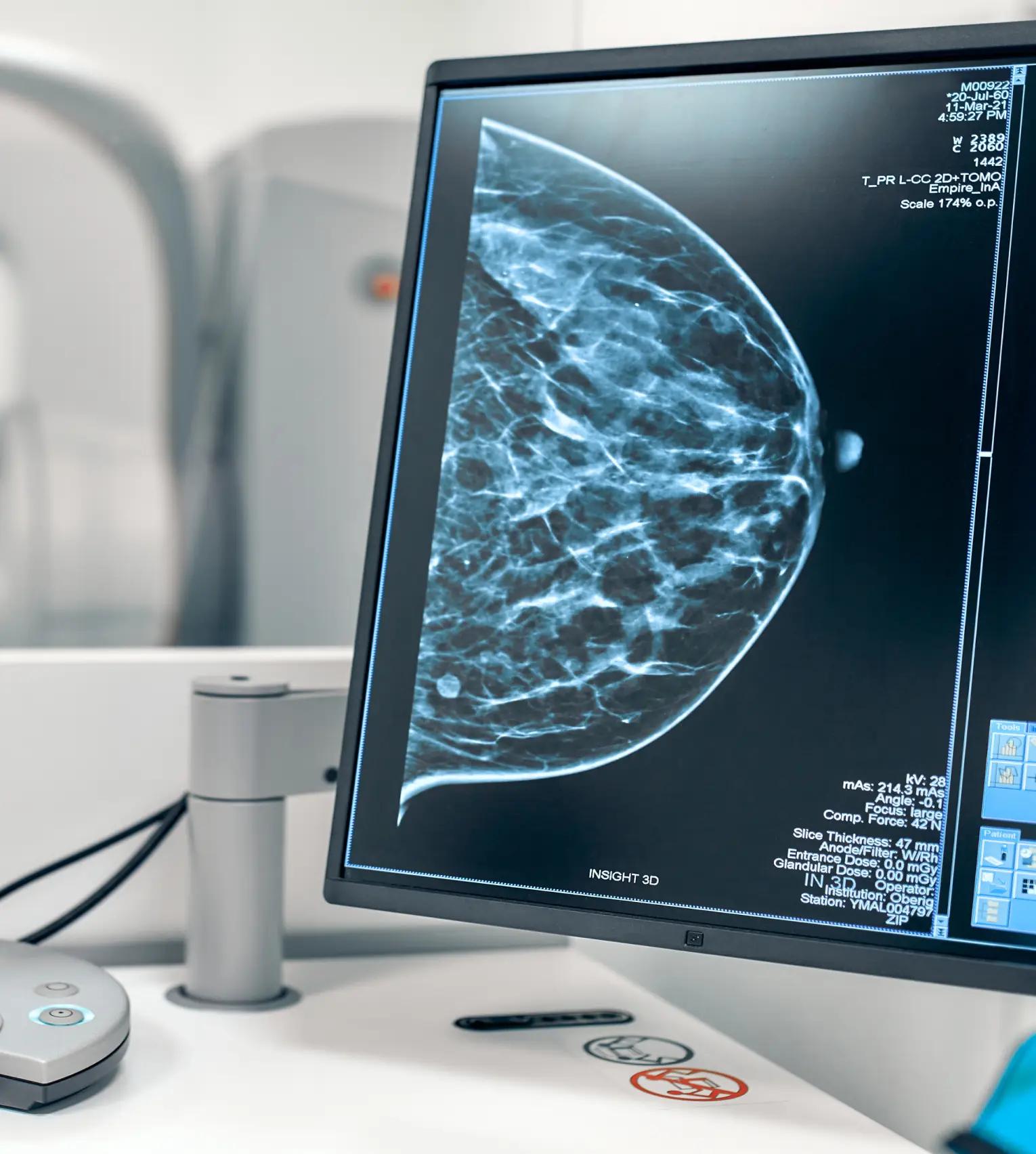 Clinical trial data analysis showing biomarker and genomics data visualization for breast cancer platform trial